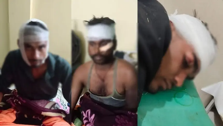 CG News : रात की सड़कों पर दहशत, DJ बजाकर घर लौट रहे युवकों से मारपीट कर डकैतों ने की लूट