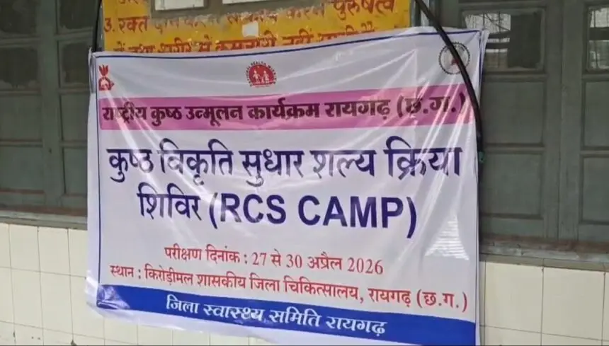 CG NEWS: रायगढ़ जिला अस्पताल में निःशुल्क कुष्ठ विकृति सुधार शिविर, 22 मरीजों का सफल ऑपरेशन