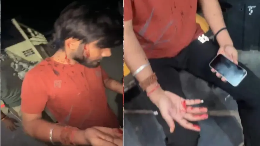 CG CRIME NEWS: देर रात खूनी संघर्ष, मामूली विवाद में युवक का फोड़ा सिर, तीन आरोपियों के खिलाफ मामला दर्ज