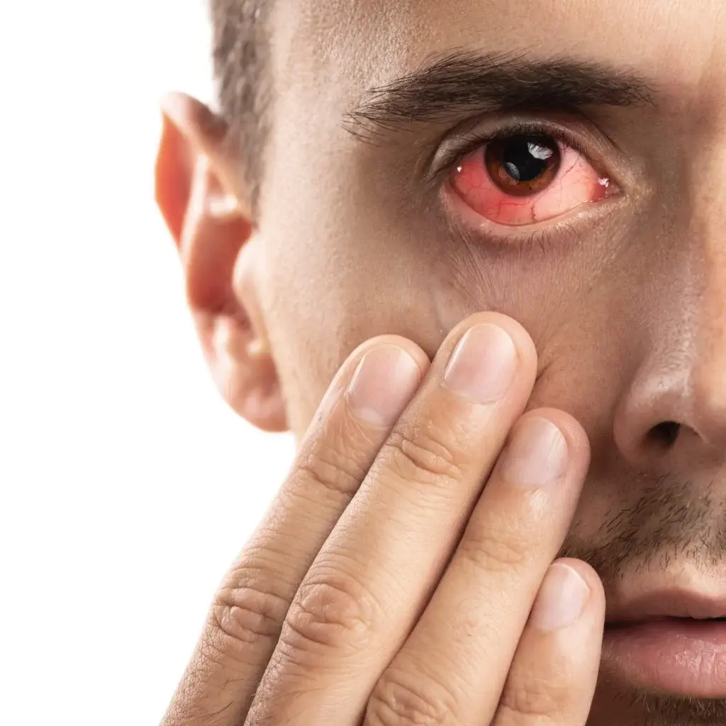 Eye Flu Alert: मानसून में बढ़ा Eye Flu का खतरा, जानिए इसके लक्षण और बचाव के आसान उपाय