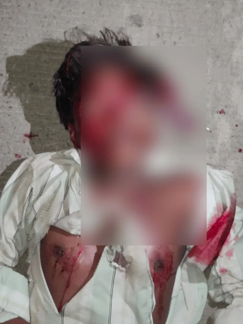 CG NEWS : सड़क हादसे में गंभीर घायल युवक की मदद को आगे आए राहगीर , बनी मानवता की मिसाल